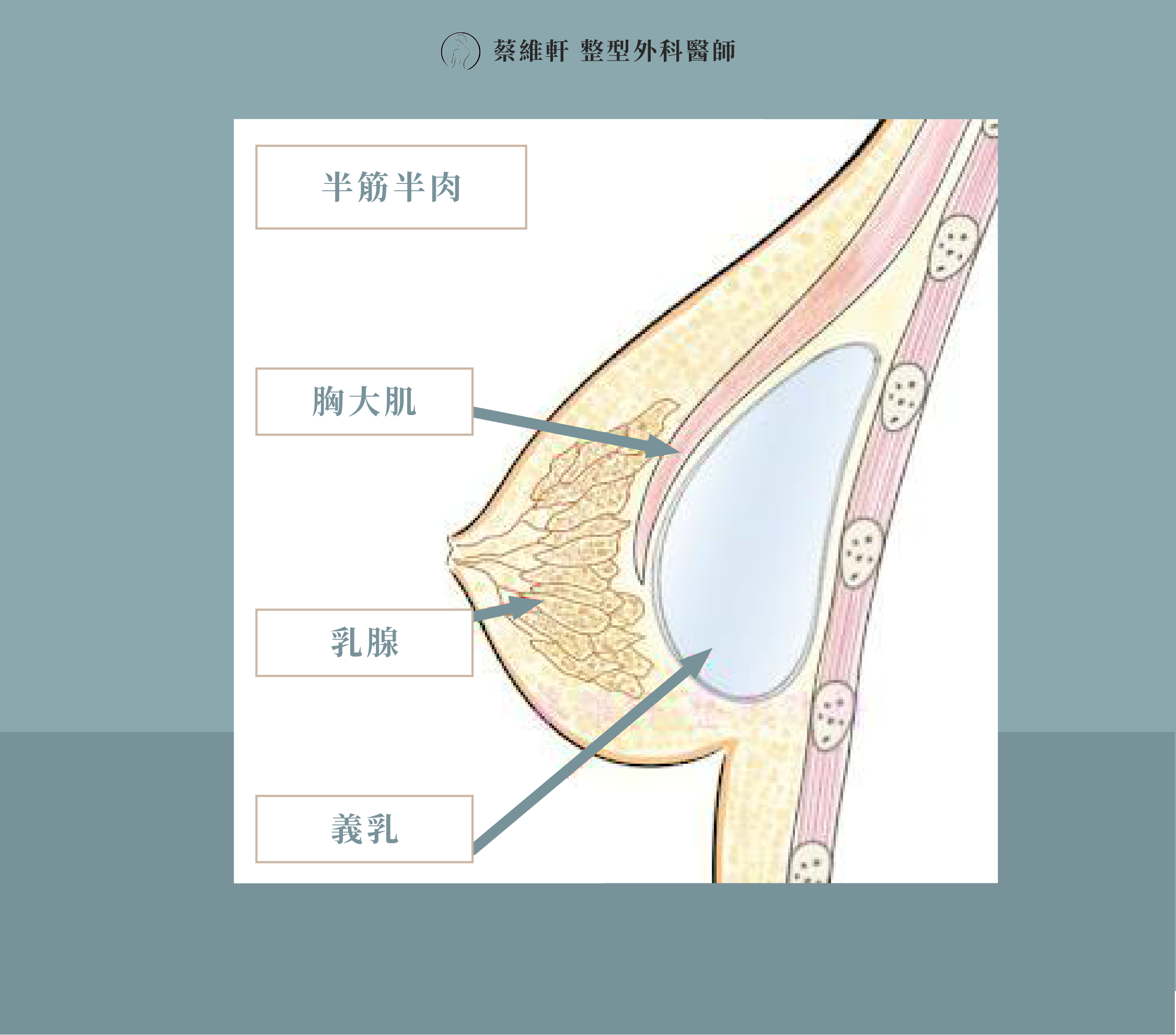 網站圖 隆乳全解析 P6 V1