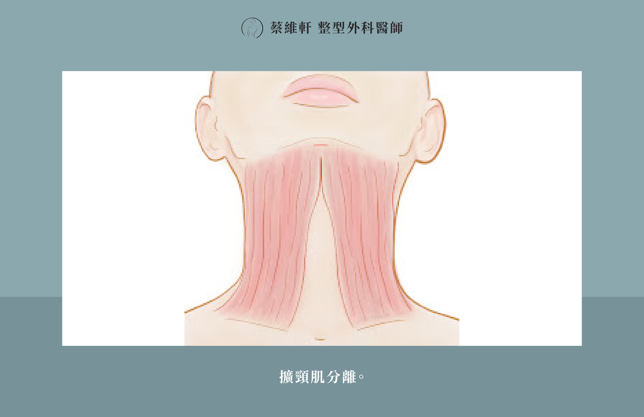 網站圖 微創天鵝頸手術P5 V1