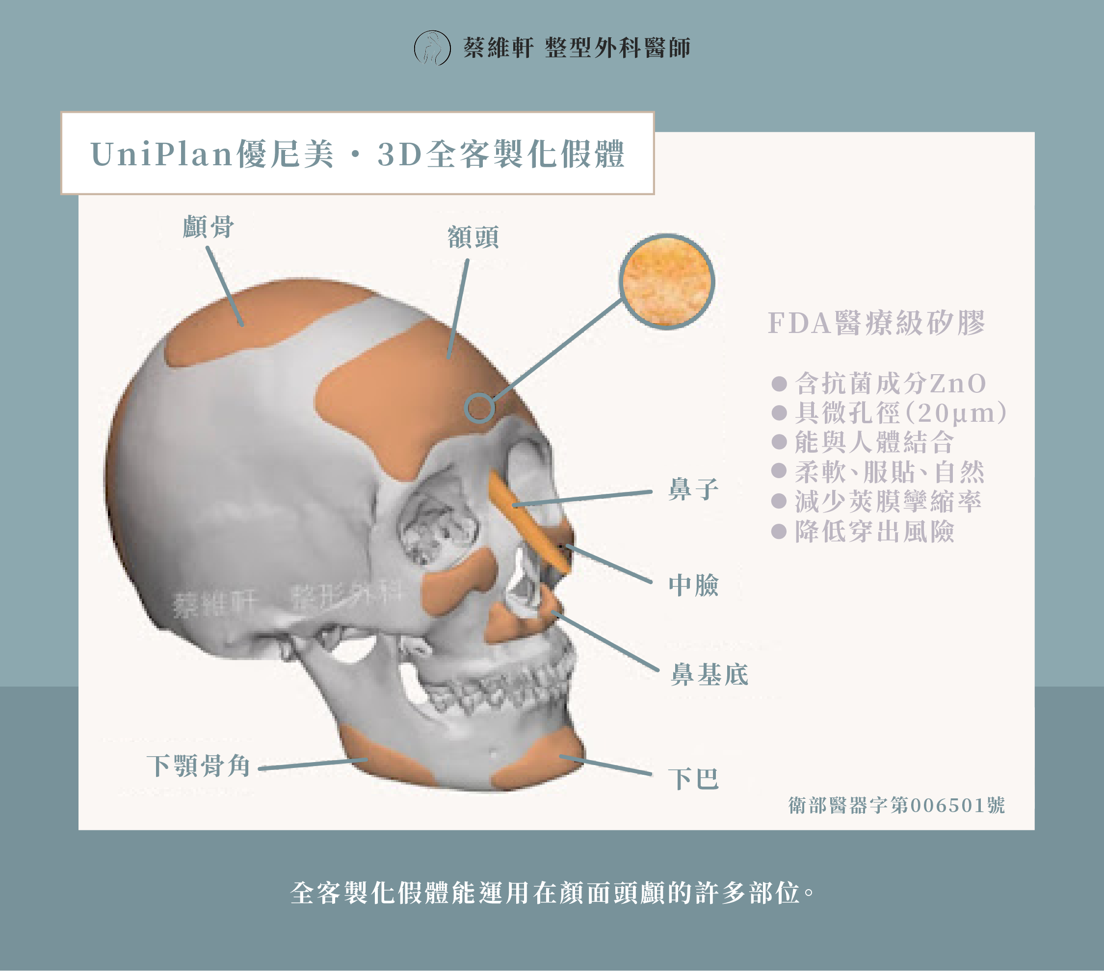 網站圖 全客製化假體P2 V1